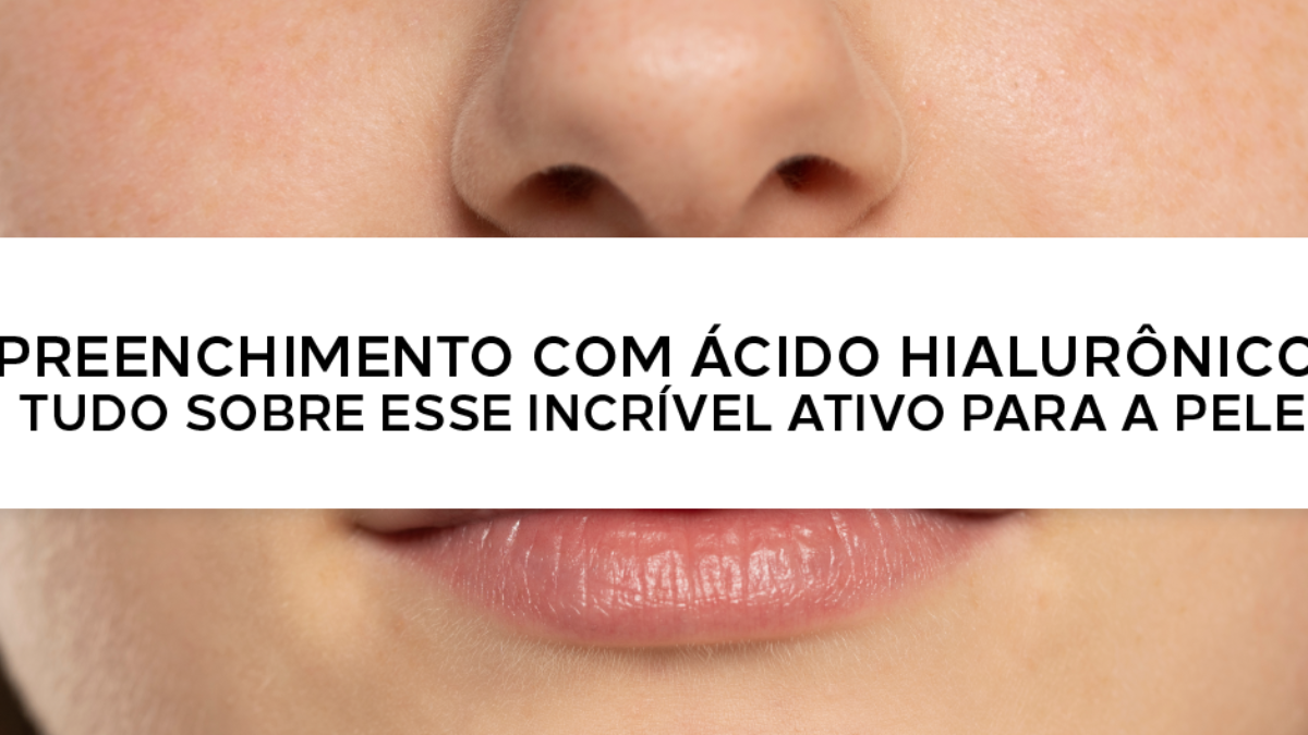 Preenchimento com Ácido Hialurônico: Diga Adeus às Ruguinhas - inspiração 1