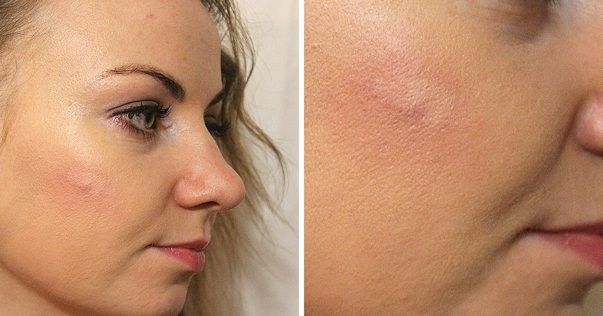 Camadas Estratégicas: Construindo a Cobertura Ideal - inspiração 1