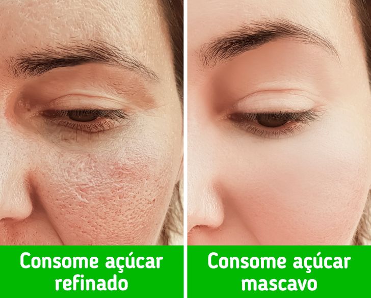 Aposte na Limpeza Profunda com Ácido Salicílico - inspiração 2