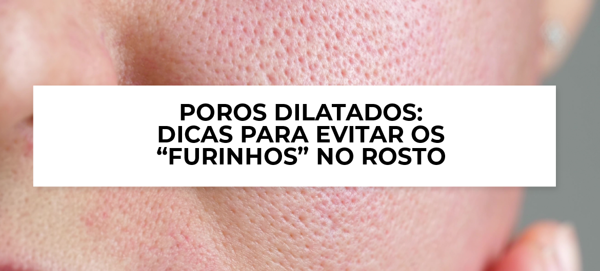 Niacinamida: Sua Aliada no Controle da Oleosidade e Textura da Pele - inspiração 1