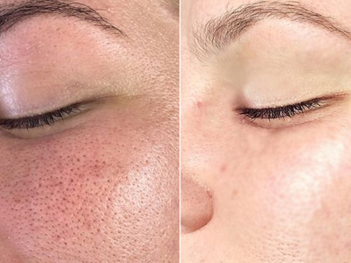 Retinol e Ácidos Retinóides: O Segredo da Renovação Celular e Firmeza - inspiração 2