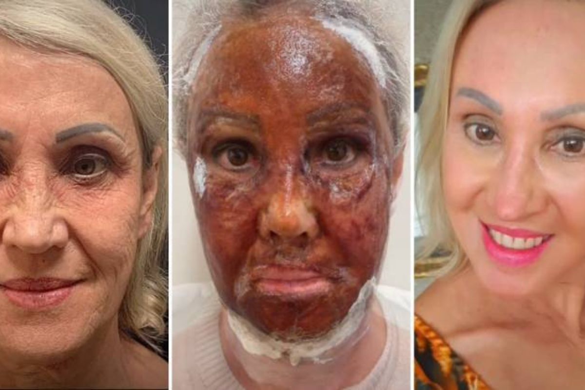 Dica 4: Respeite o Tempo de Aplicação Para Evitar Irritações - inspiração 2