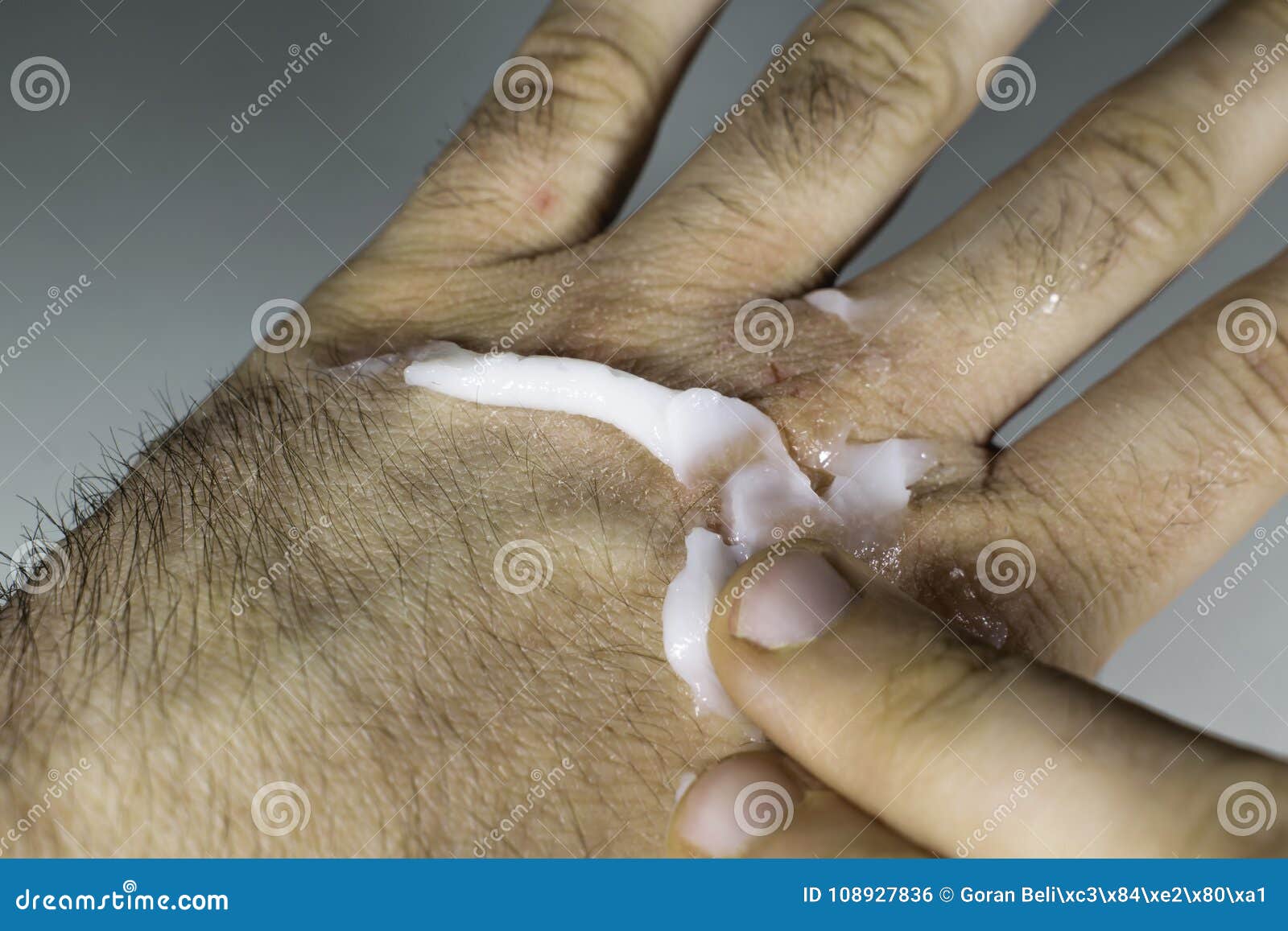 Bepantol Derma: A Solução Multifuncional para Mãos, Unhas e Cutículas - inspiração 1