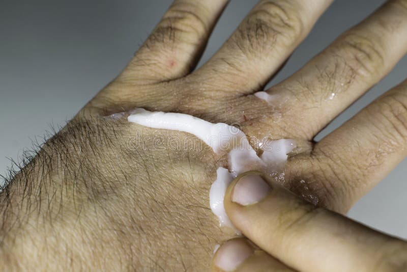 Ceramidas: Blinde Suas Mãos Contra o Ressecamento - inspiração 2