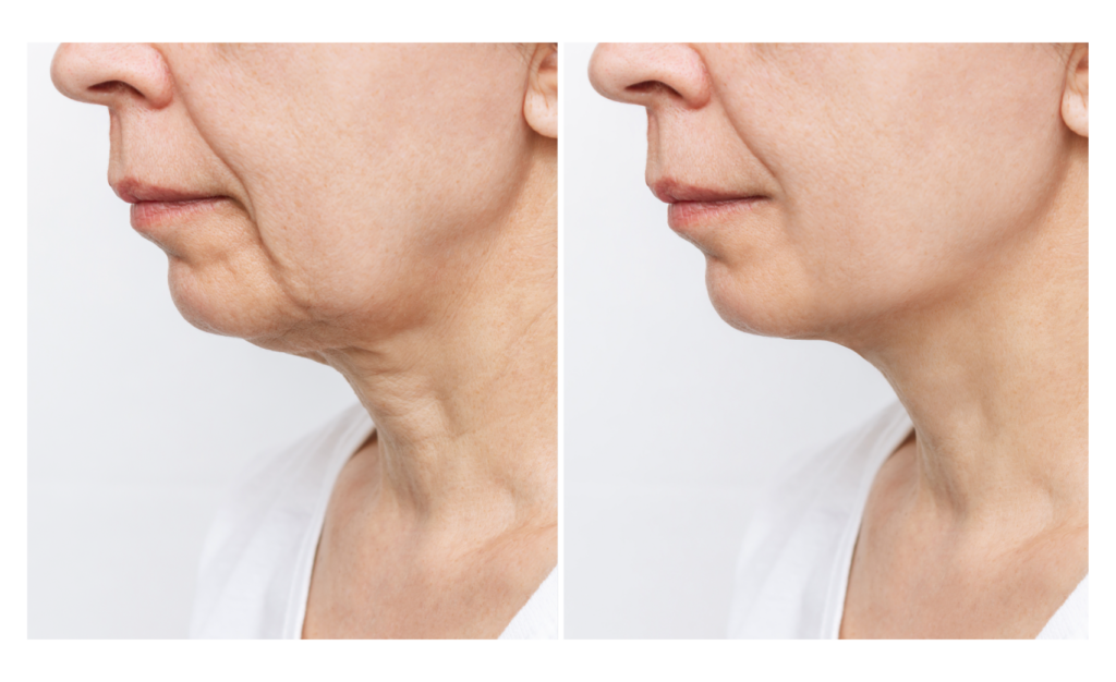 Ivy C Corpo e Colo: Rejuvenesça com Proteção Solar - inspiração 3