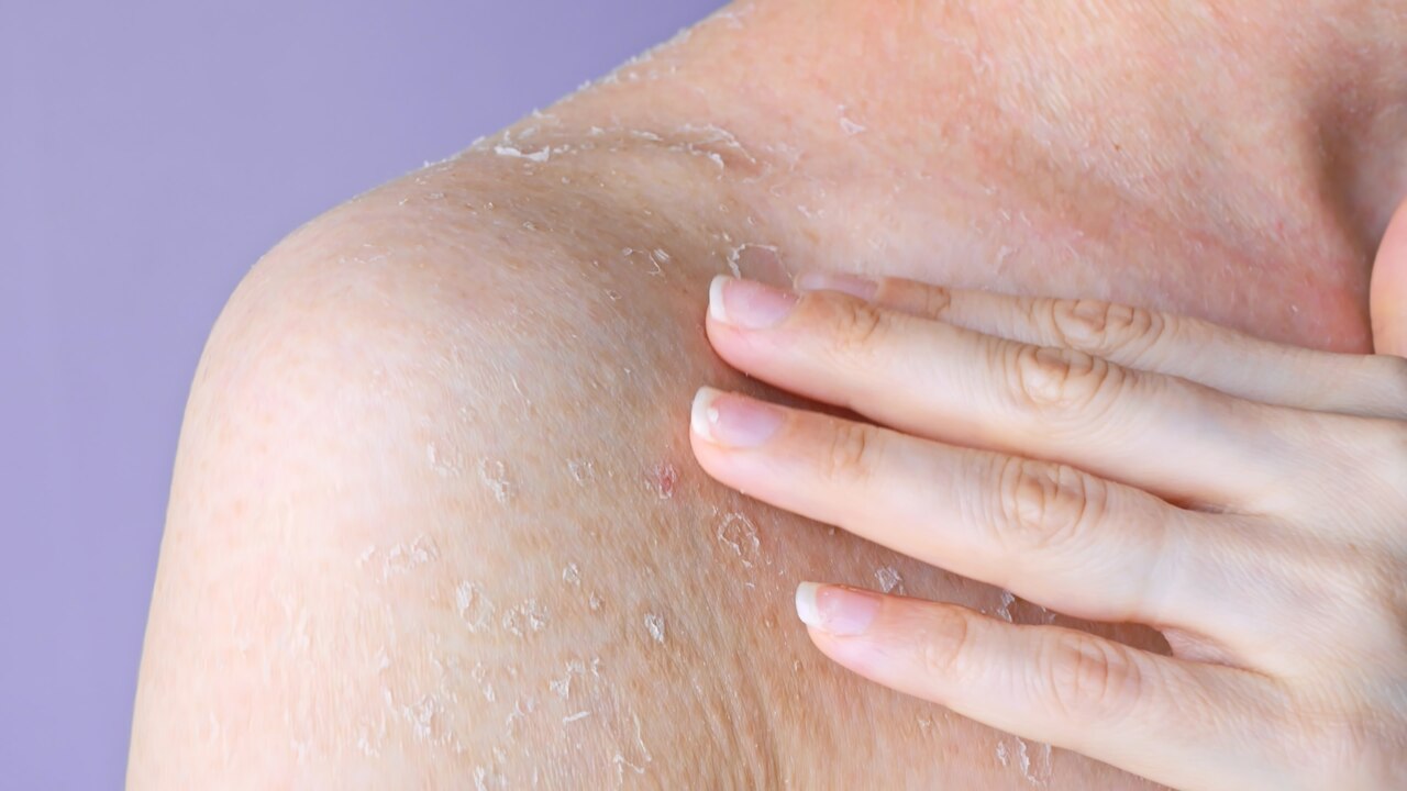 Alimentação Poderosa: Nutrientes que Blindam a Sua Pele - inspiração 1