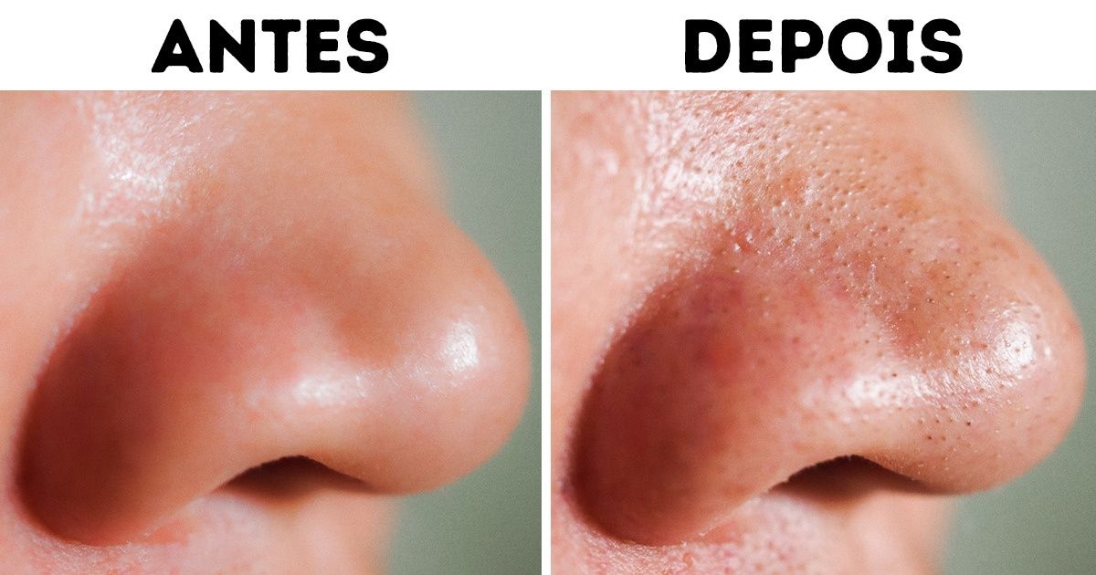 Erro Fatal: Esquecer de Hidratar Depois - inspiração 2