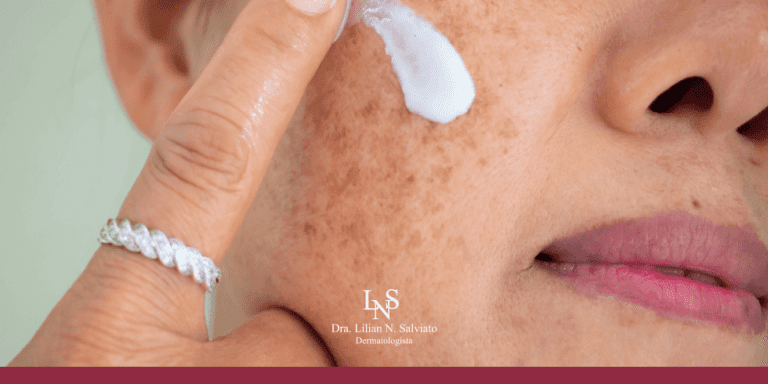 Ativos Clareadores no Protetor Solar: Quais procurar? - inspiração 1