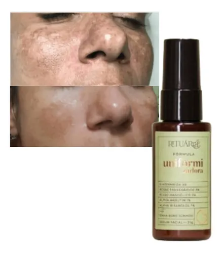 Soluções Para Pele Sensível Que Usa Clareadores - inspiração 2