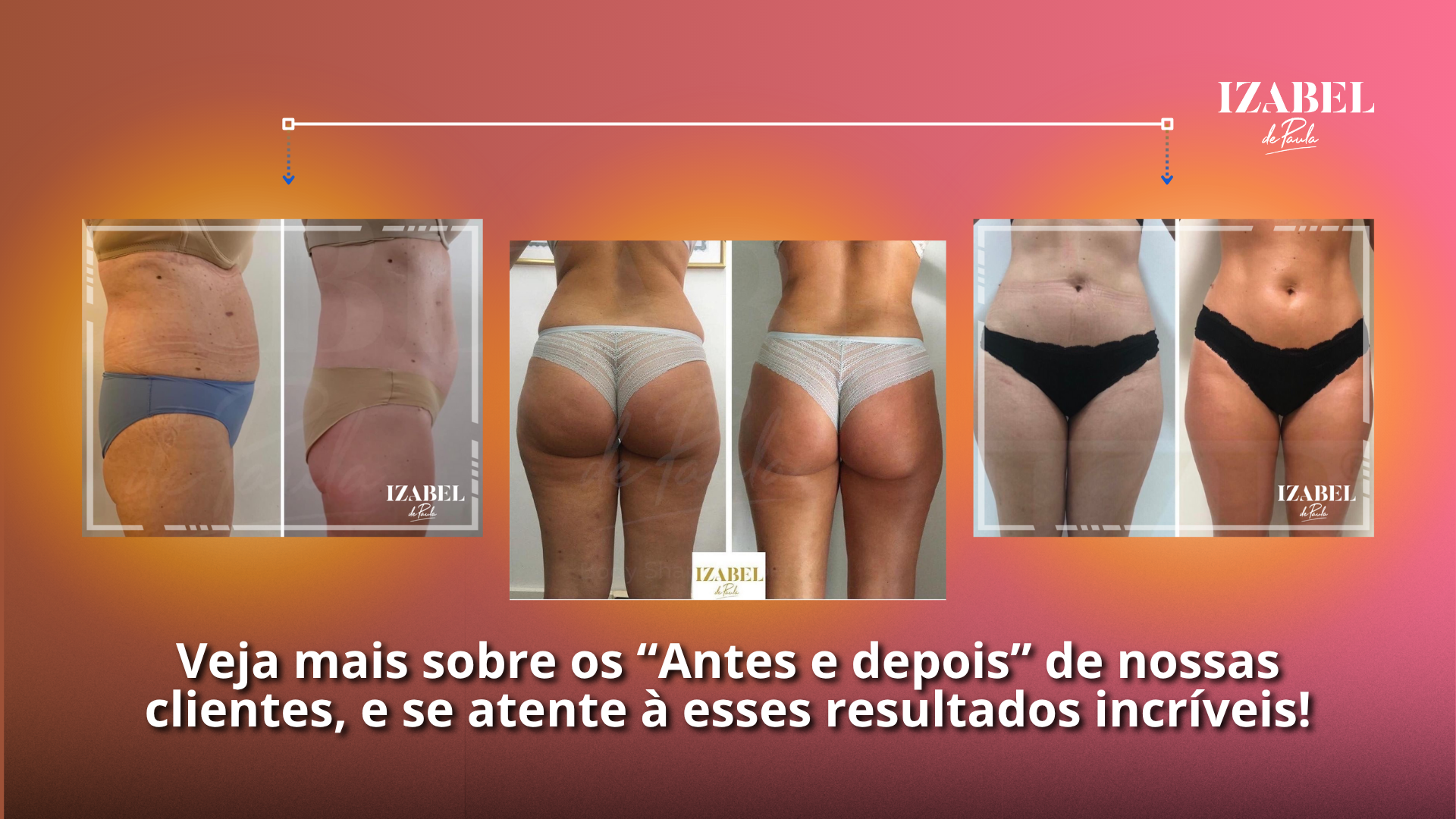 Drenagem Linfática Caseira: Desinche e Ative a Circulação - inspiração 1