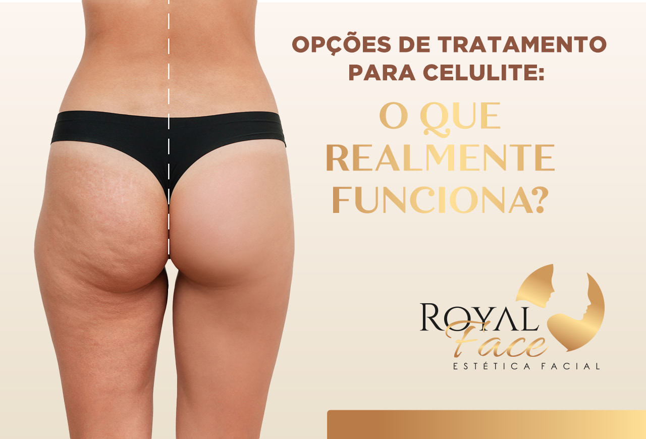 Alimentos Que Desinflamam: Seu Cardápio Secreto Anticelulite - inspiração 1