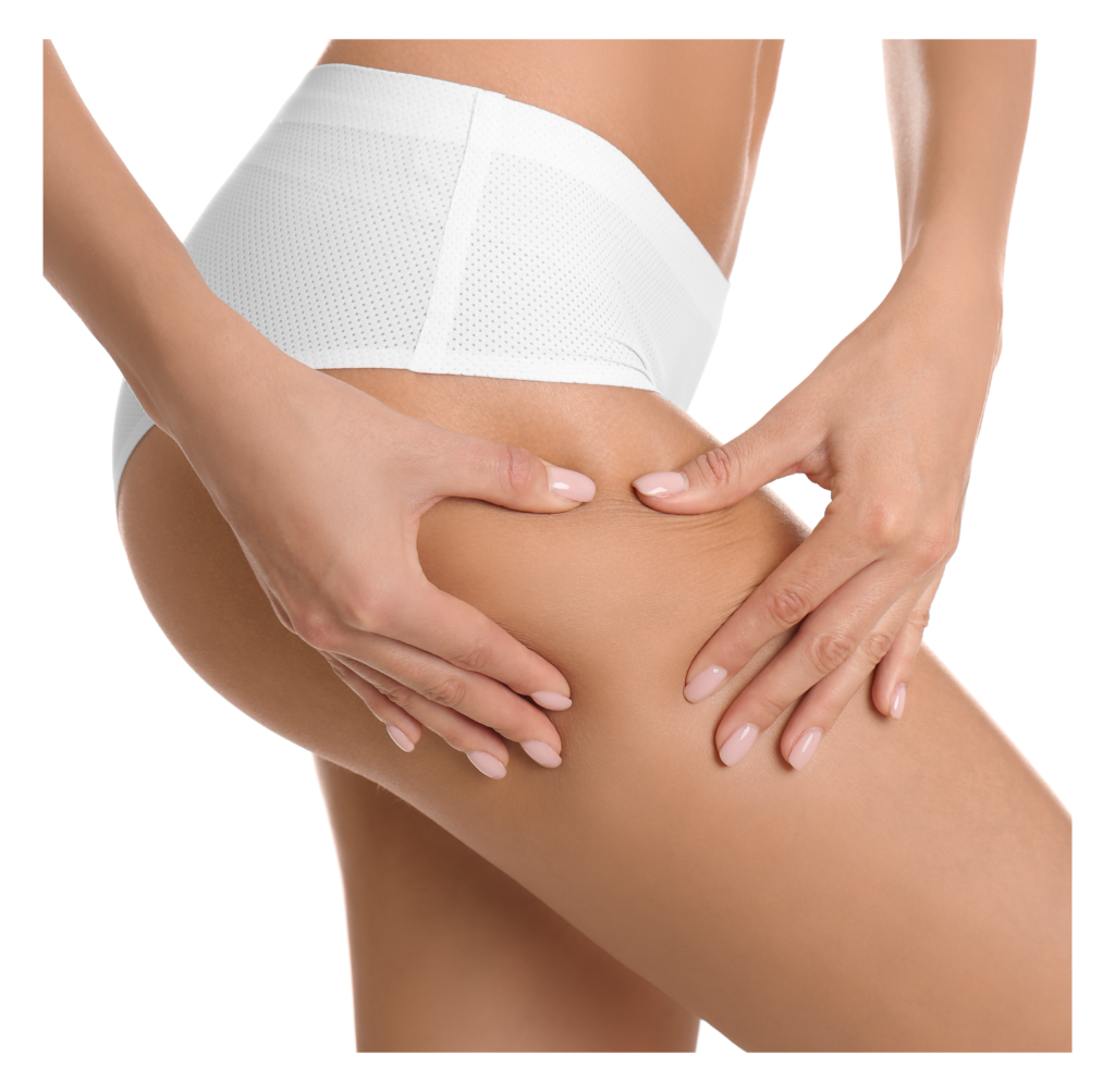 Alimentos Que Desinflamam: Seu Cardápio Secreto Anticelulite - inspiração 3