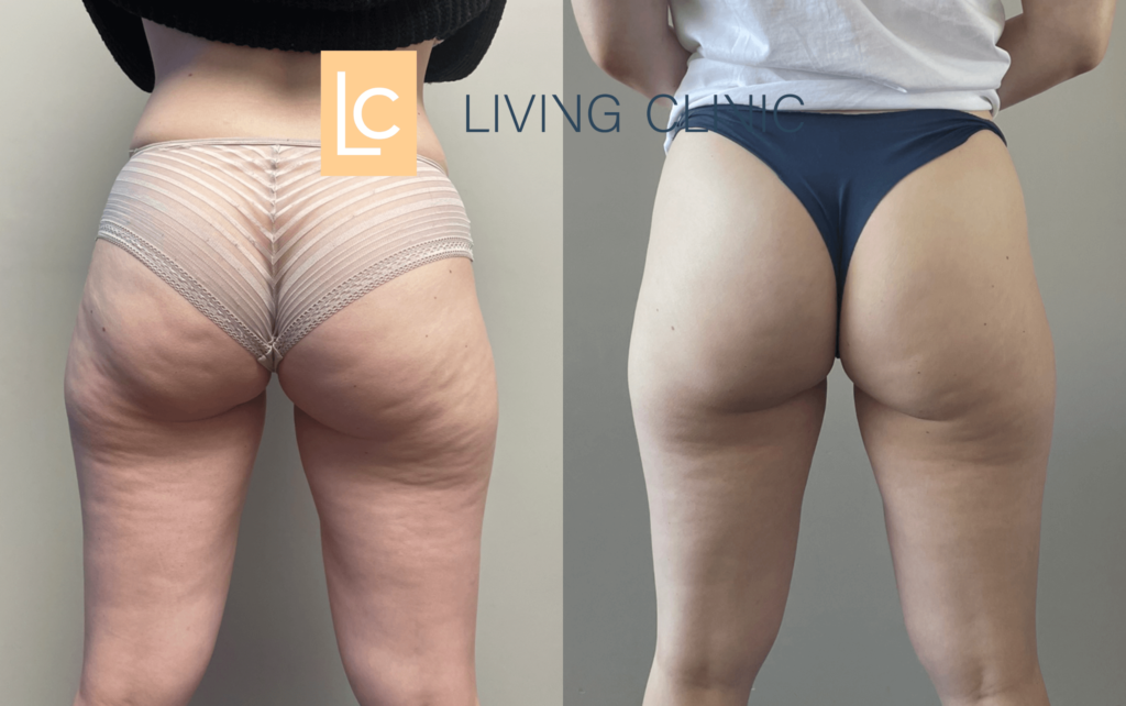 Receitas de Chás Diuréticos: Detox Natural Para Uma Pele Mais Lisa - inspiração 3