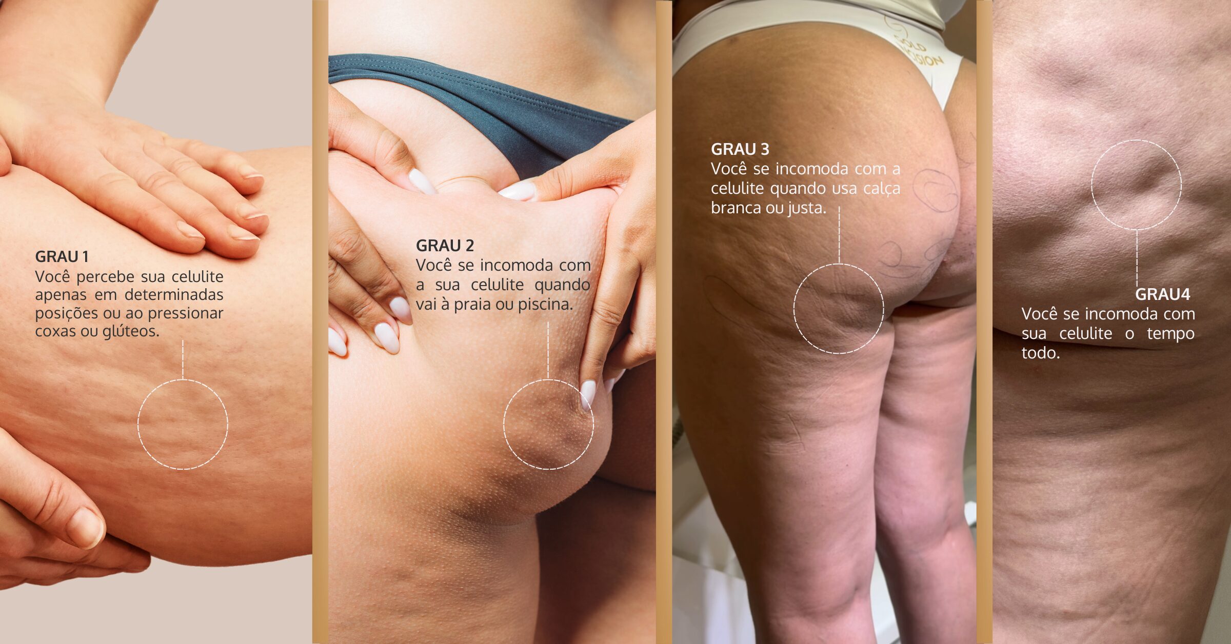 A Importância da Hidratação: Água, Sua Fonte da Beleza - inspiração 3