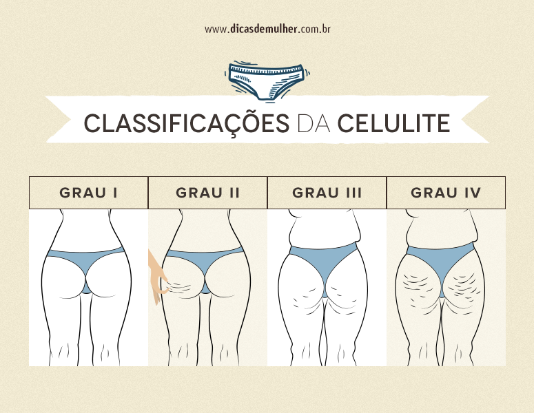 Suplementação Inteligente: Nutrientes Que Potencializam Seus Resultados - inspiração 1