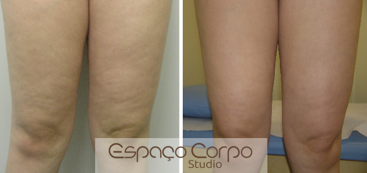 Suplementação Inteligente: Nutrientes Que Potencializam Seus Resultados - inspiração 3