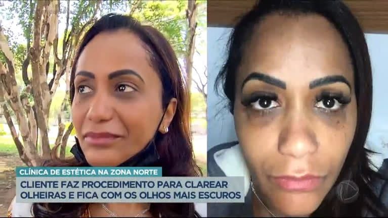 Cremes Clareadores: Vitamina C e Niacinamida como Aliadas - inspiração 3