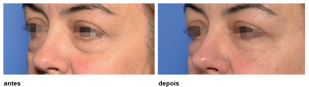 Sono e Hidratação: A Base de uma Pele Saudável - inspiração 2