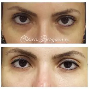 Retinol: Renovação Celular para uma Pele Radiante - inspiração 1