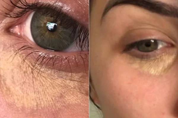 Retinol: Renovação Celular para uma Pele Radiante - inspiração 2