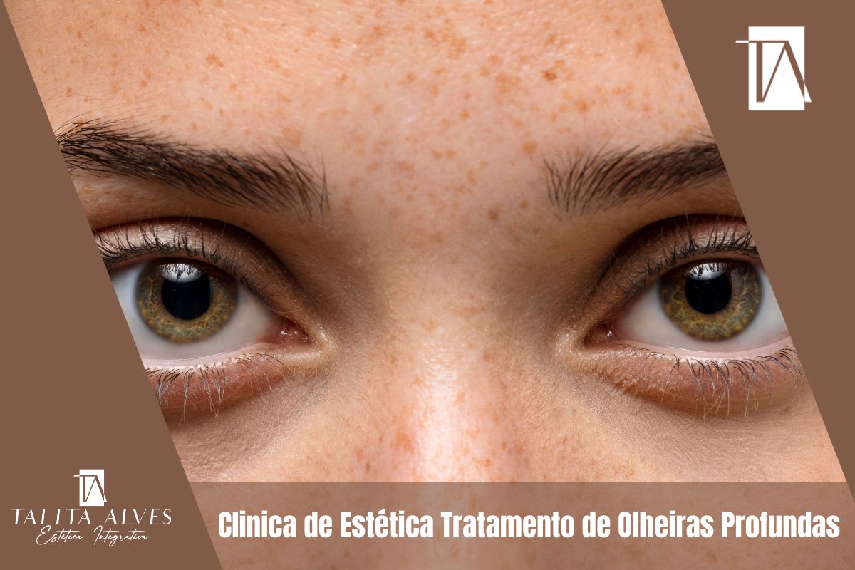 Preenchimento com Ácido Hialurônico: Volume e Contorno Restaurados - inspiração 1