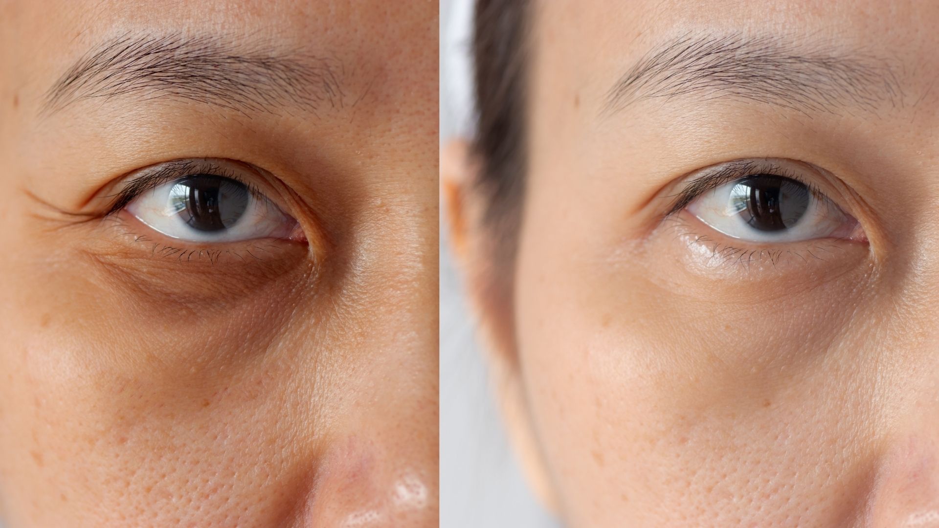 Peeling Químico: Renovação da Pele em Nível Celular - inspiração 2