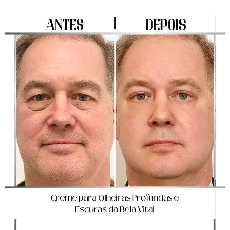 Peeling Químico: Renovação da Pele em Nível Celular - inspiração 3