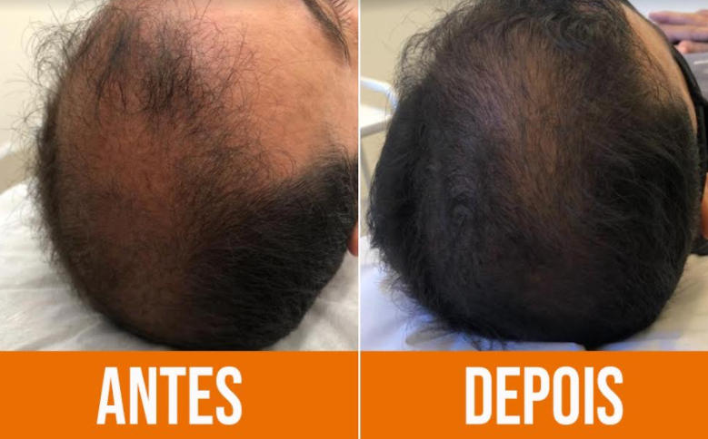 Suplementação Inteligente: Nutrição de Dentro para Fora - inspiração 1