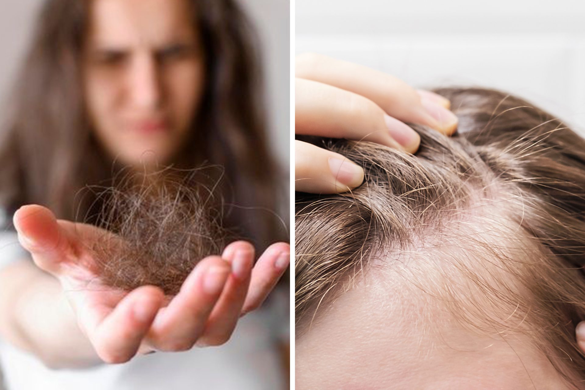 Microagulhamento (MMP): A Farmácia Direto no Couro Cabeludo - inspiração 3