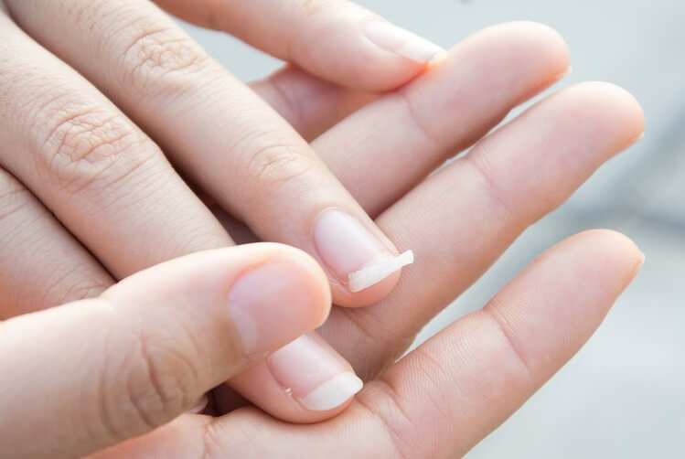 Dica #1: Blindagem Caseira com Alho e Cravo - inspiração 1