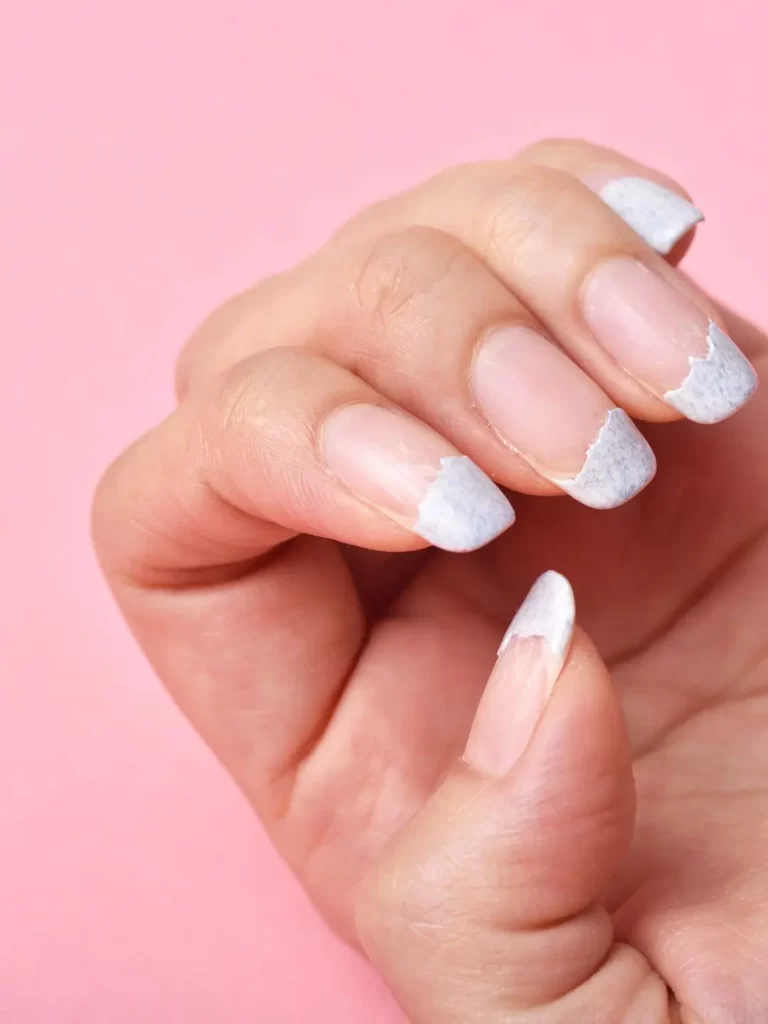 Dica #10: Atenção aos Sinais: Quando Procurar um Dermatologista - inspiração 3