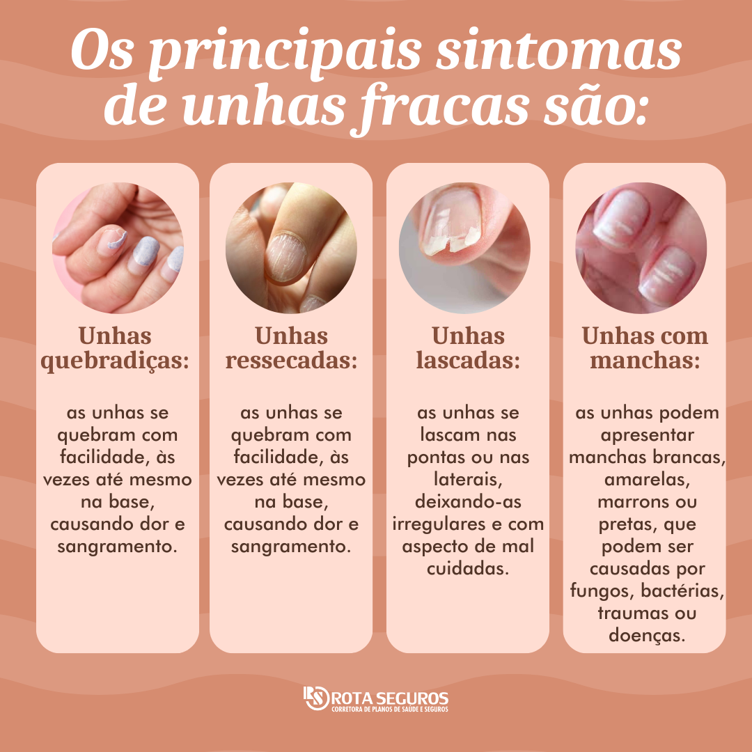 Dica #4: Escolha Inteligente: Acetona vs. Removedor Sem Acetona - inspiração 1