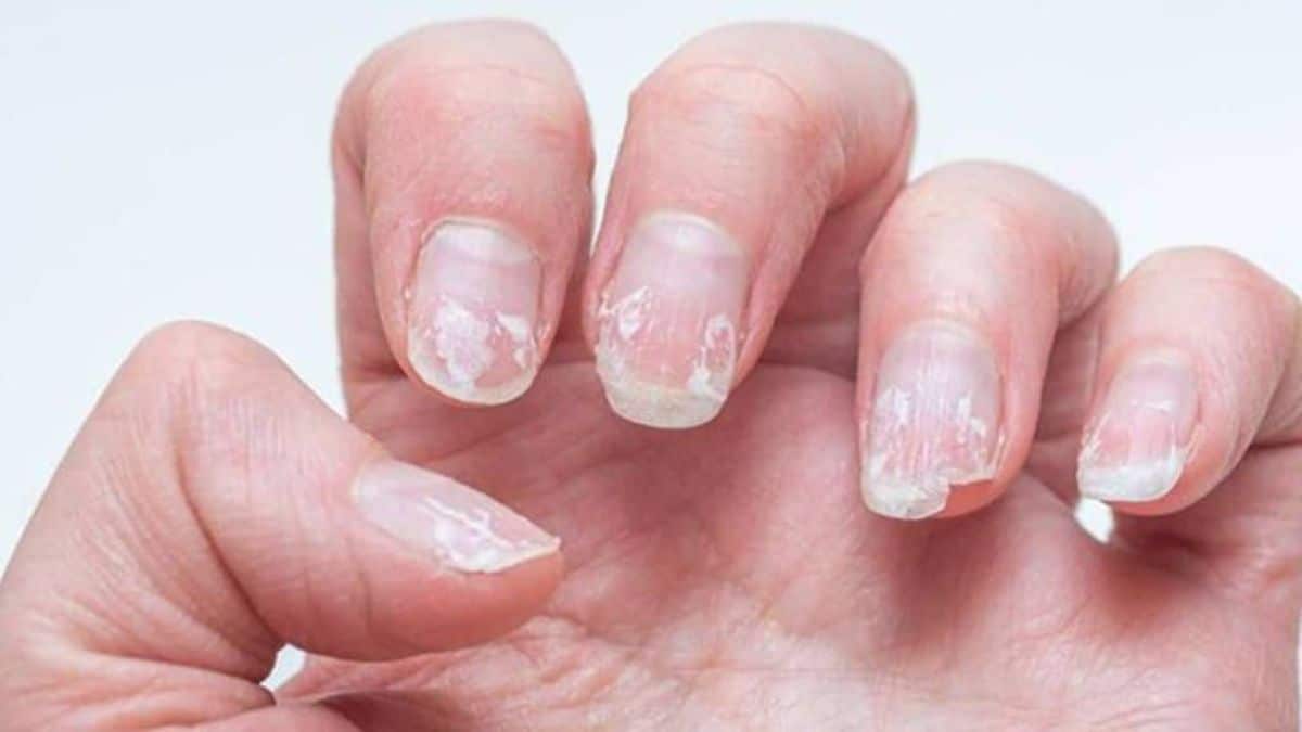 Dica #4: Escolha Inteligente: Acetona vs. Removedor Sem Acetona - inspiração 3