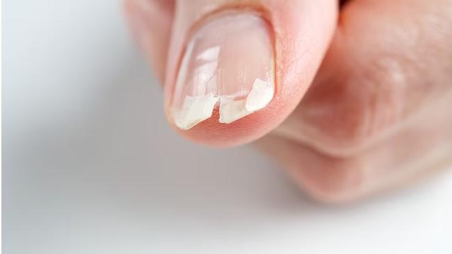 Dica #9: Luvas Sempre: Proteção Contra Agentes Agressivos - inspiração 1