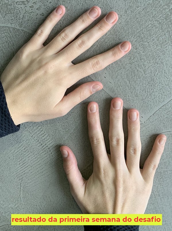 Grupos de Apoio: Compartilhe Desafios e Conquistas - inspiração 1