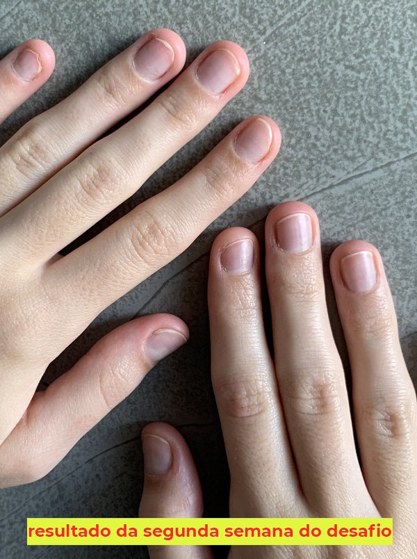 Registro Fotográfico: Visualize o Progresso e Motive-se - inspiração 1