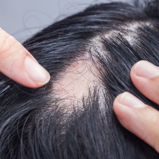 Terapias Tópicas e Medicamentos: Opções Acessíveis - inspiração 1