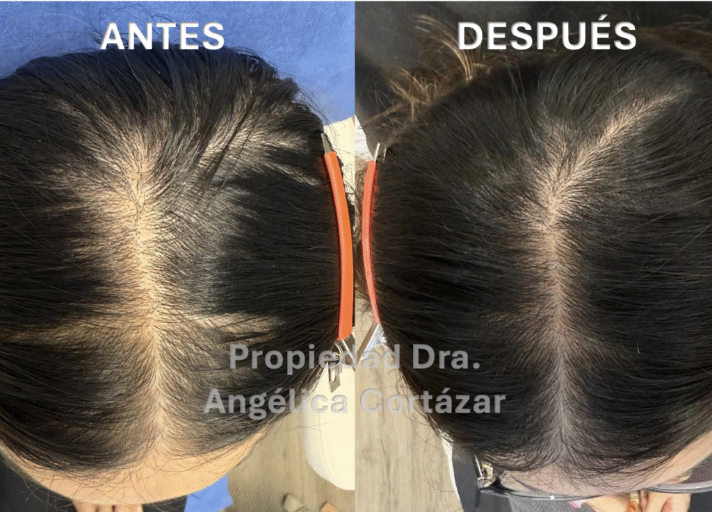 Cuidados Essenciais para Fortalecer Seus Cabelos no Dia a Dia - inspiração 2