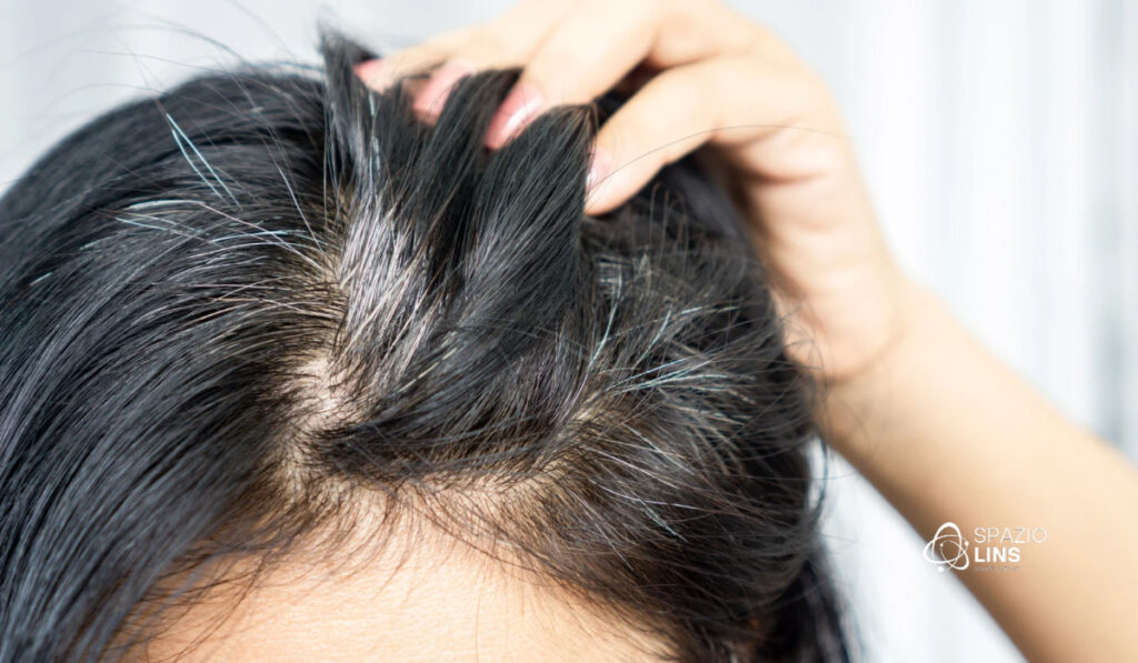 Estresse e Estilo de Vida: Impactos Reais na Pigmentação Capilar - inspiração 2