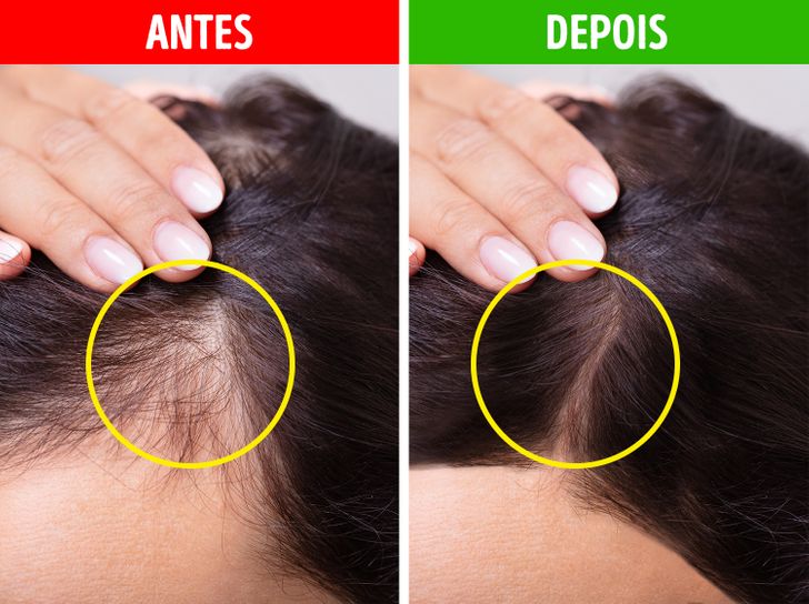 Avaliando a Estrutura do Seu Cabelo para Melhorar o Volume - inspiração 2