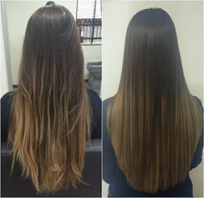 Manutenção Pós-Cauterização: Prolongando os Benefícios - inspiração 2