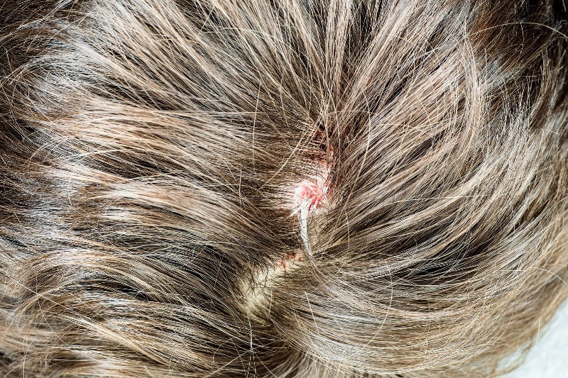 Shampoos Terapêuticos: Um Guia para Escolher o Certo - inspiração 2