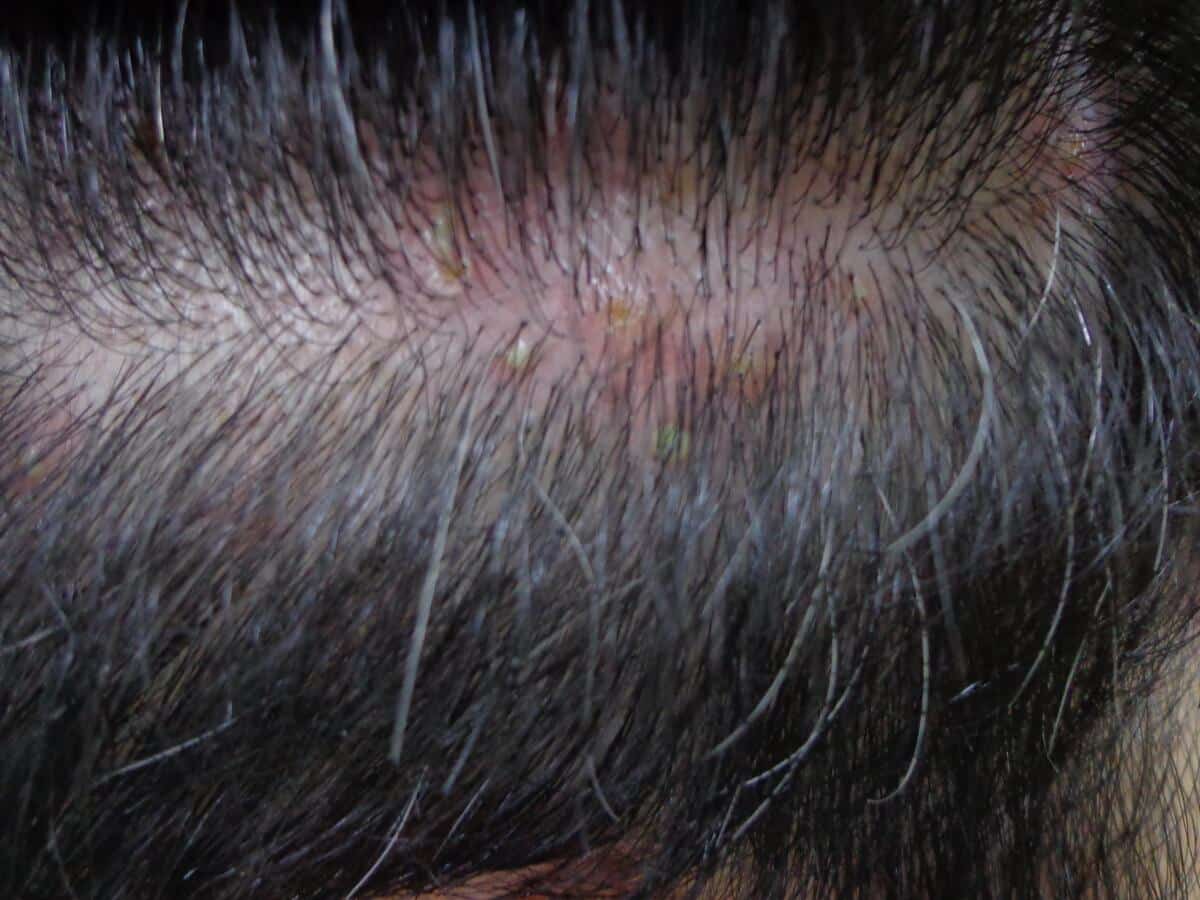 Cuidados com o Cabelo: Pequenas Mudanças que Fazem Grande Diferença - inspiração 2