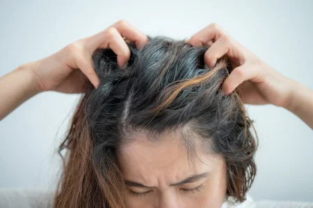 Alimentação e Bem-Estar: O Impacto na Saúde do Couro Cabeludo - inspiração 1