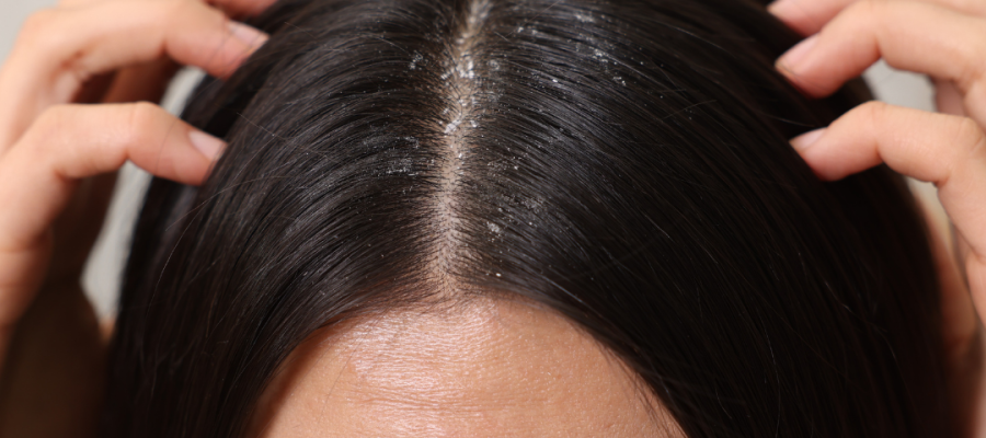 Evitando Gatilhos: Identificando e Fugindo de Irritantes Comuns - inspiração 1