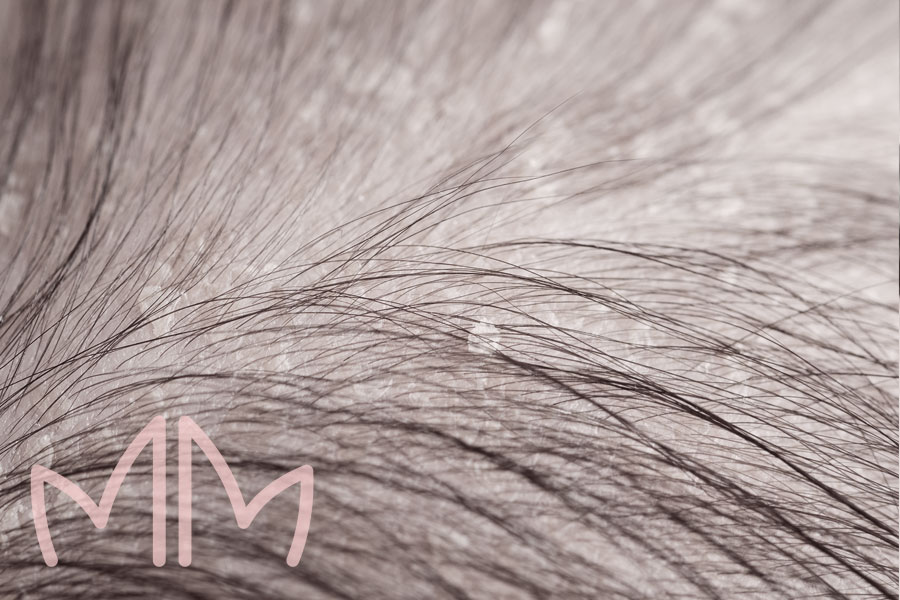 A Importância da Higiene Adequada: Limpeza Sem Agredir - inspiração 1