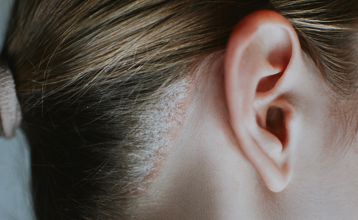 Dicas Práticas Para Manter o Couro Cabeludo Saudável no Dia a Dia - inspiração 2