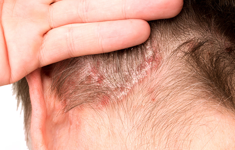 Rotina de Lavagem: A Frequência Ideal Para o Seu Tipo de Cabelo e Pele - inspiração 1