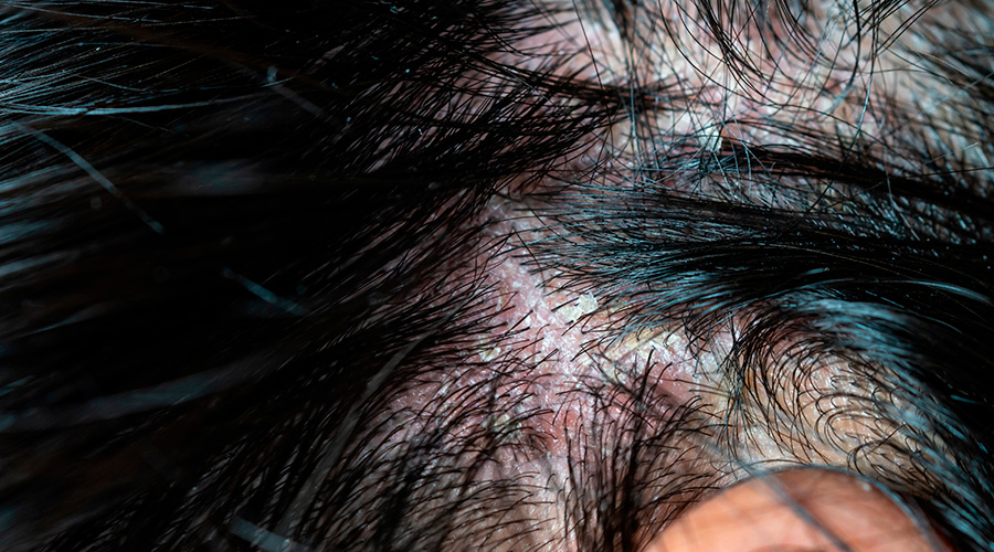 Cuidados Extras: Máscaras e Hidratações Específicas - inspiração 2