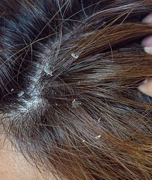 Impacto Emocional: Como Lidar com a Autoestima e o Desconforto - inspiração 1